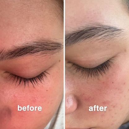 Aloria™ Eyelash Growth Serum