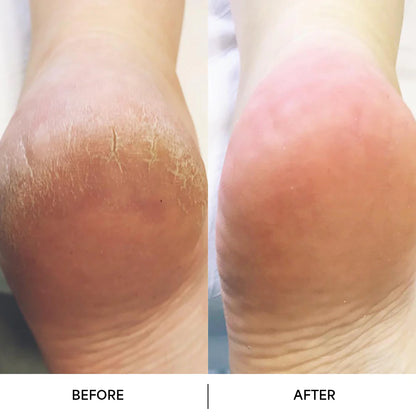 Aloria Crack-Free Overnight Recovery Cream