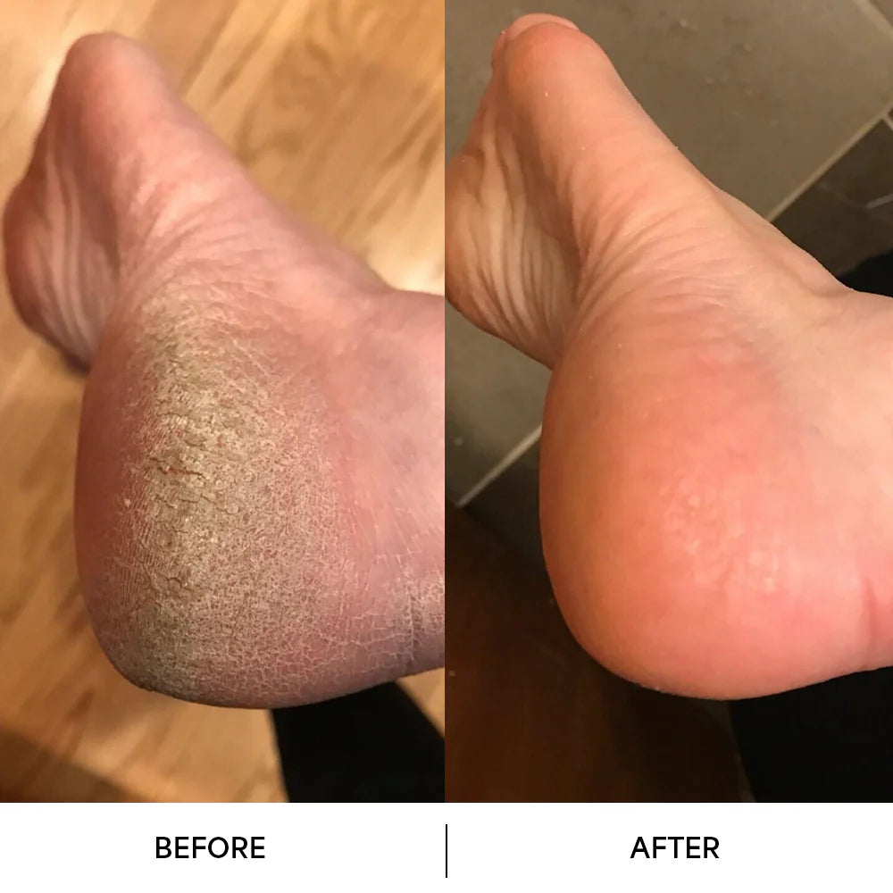 Aloria Crack-Free Overnight Recovery Cream