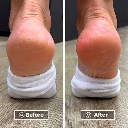 Aloria Crack-Free Overnight Recovery Cream