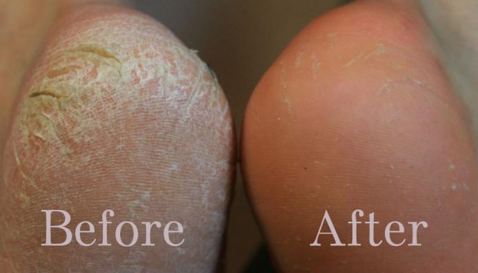 Aloria Crack-Free Overnight Recovery Cream